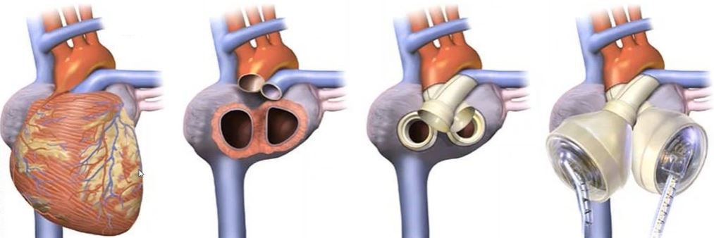 medical device simulation consulting