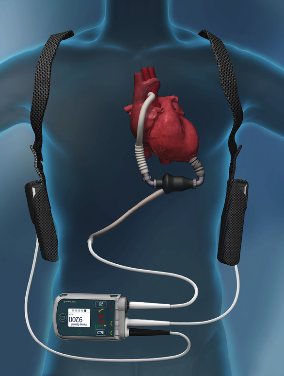 Medical-Device-Simulation-SimuTech-Optical-Consultants-en-soins-de-santé