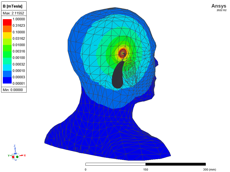 magnetic flux density in the body