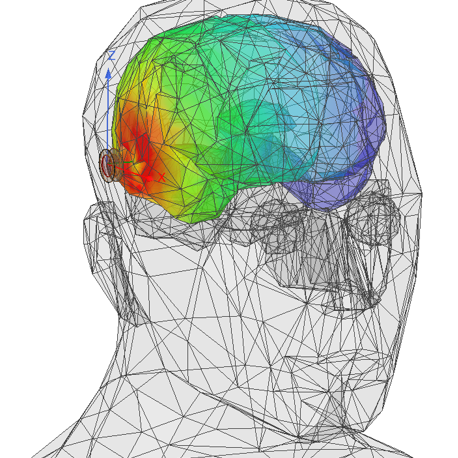 sar in the human brain