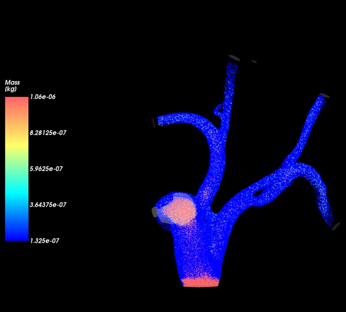 Simpleware FreeFlow blood flow modeling efinement of SPH elements feature