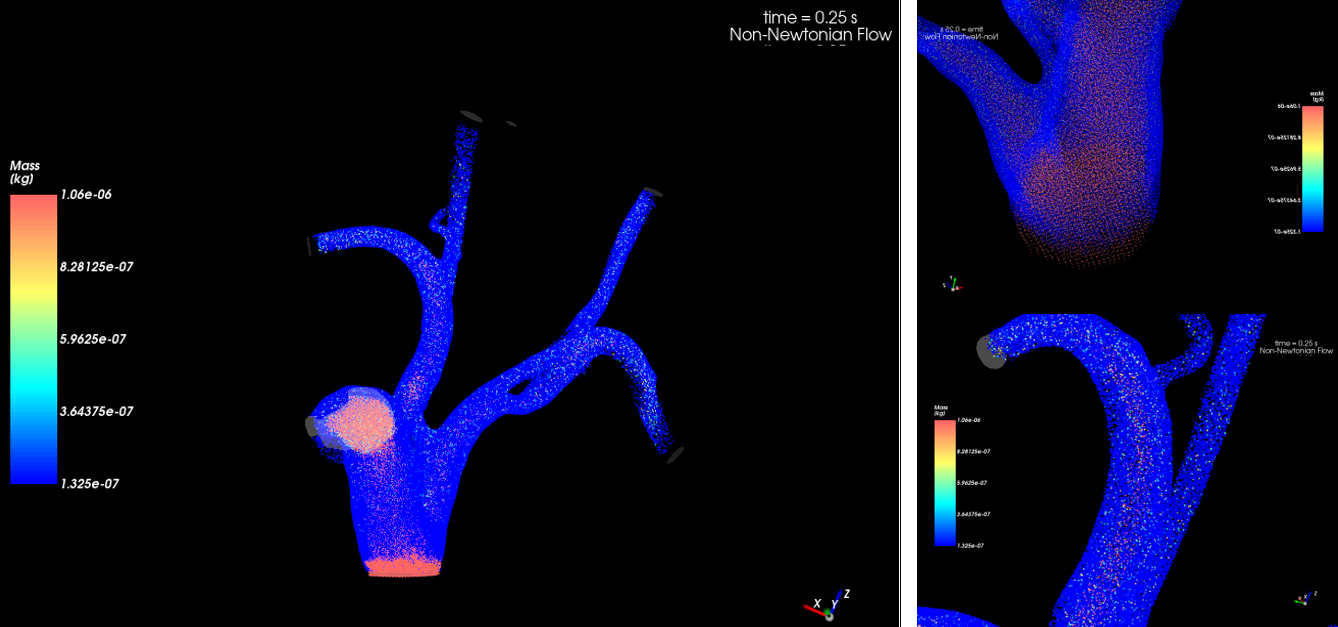 Simpleware FreeFlow blood flow modeling efinement of SPH elements