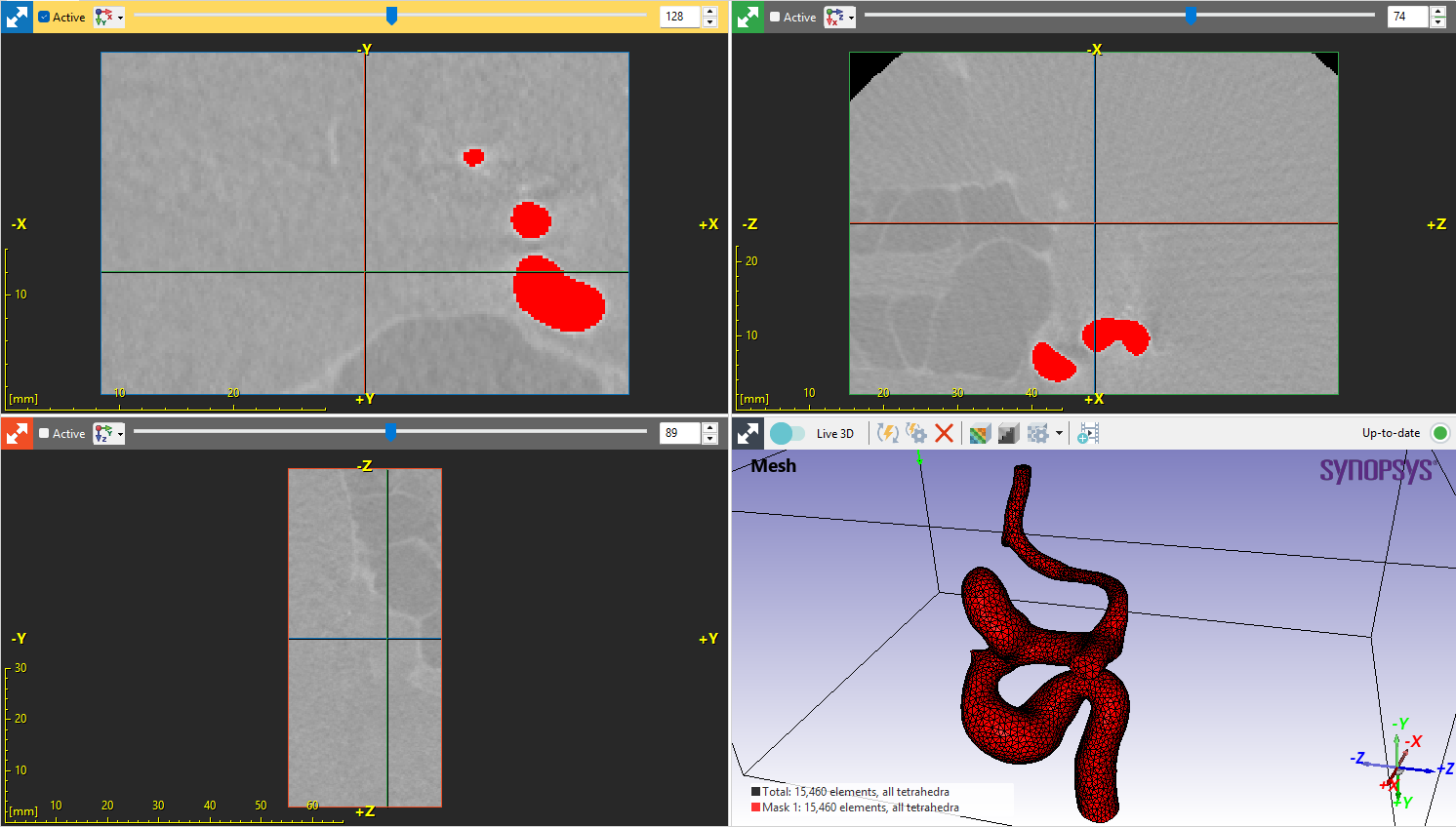 Simpleware FreeFlow blood flow modeling transferring mesh as a geometry into FreeFlow